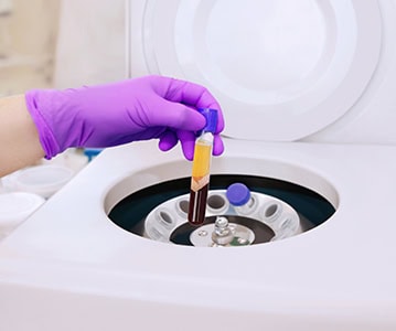 PRP Therapy New Haven